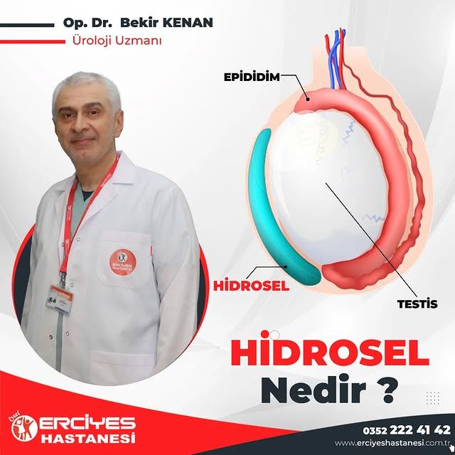 Hidrosel Nedir ve Nasıl Tedavi Edilir?